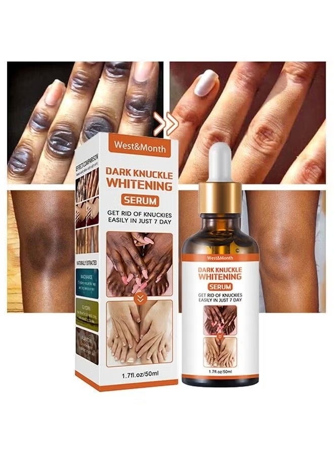 West&Month Dark knuckle Whitening Serum,7 days Treatment for Dark Spots in Hand and Feet Knuckles Exfoliating Improves Dullness Powerful Whitening Effect for Men and Women 50ml - Image 1